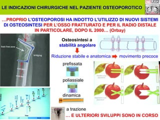 LE INDICAZIONI CHIRURGICHE NEL PAZIENTE OSTEOPOROTICO
…PROPRIO L’OSTEOPOROSI HA INDOTTO L’UTILIZZO DI NUOVI SISTEMI
DI OSTEOSINTESI PER L’OSSO FRATTURATO E PER IL RADIO DISTALE
IN PARTICOLARE, DOPO IL 2000… (Orbay)
Osteosintesi a
stabilità angolare
Riduzione stabile e anatomica

movimento precoce

prefissata

poliassiale
dinamica
a trazione
… E ULTERIORI SVILUPPI SONO IN CORSO

 