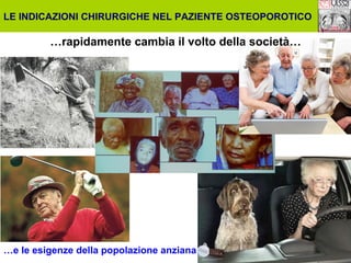 LE INDICAZIONI CHIRURGICHE NEL PAZIENTE OSTEOPOROTICO

…rapidamente cambia il volto della società…

…e le esigenze della popolazione anziana

 