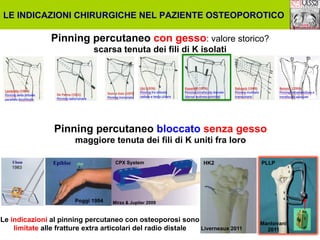 LE INDICAZIONI CHIRURGICHE NEL PAZIENTE OSTEOPOROTICO

Pinning percutaneo con gesso: valore storico?
scarsa tenuta dei fili di K isolati

Pinning percutaneo bloccato senza gesso
maggiore tenuta dei fili di K uniti fra loro
CPX System

1983

Poggi 1994

HK2

PLLP

Mirza & Jupiter 2009

Le indicazioni al pinning percutaneo con osteoporosi sono
Liverneaux 2011
limitate alle fratture extra articolari del radio distale

Mantovani
2011

 
