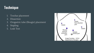 Bariactic surgery.pptx