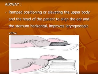 AIRWAY :
 Ramped positioning or elevating the upper body
and the head of the patient to align the ear and
the sternum horizontal, improves laryngoscopic
view.
 
