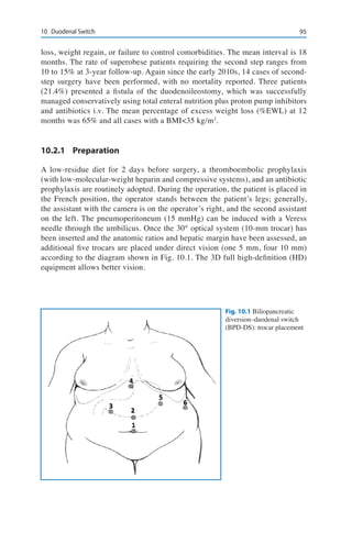 9510	 Duodenal Switch
loss, weight regain, or failure to control comorbidities. The mean interval is 18
months. The rate of superobese patients requiring the second step ranges from
10 to 15% at 3-year follow-up. Again since the early 2010s, 14 cases of second-
step surgery have been performed, with no mortality reported. Three patients
(21.4%) presented a fistula of the duodenoileostomy, which was successfully
managed conservatively using total enteral nutrition plus proton pump inhibitors
and antibiotics i.v. The mean percentage of excess weight loss (%EWL) at 12
months was 65% and all cases with a BMI<35 kg/m2
.
10.2.1	Preparation
A low-residue diet for 2 days before surgery, a thromboembolic prophylaxis
(with low-molecular-weight heparin and compressive systems), and an antibiotic
prophylaxis are routinely adopted. During the operation, the patient is placed in
the French position, the operator stands between the patient’s legs; generally,
the assistant with the camera is on the operator’s right, and the second assistant
on the left. The pneumoperitoneum (15 mmHg) can be induced with a Veress
needle through the umbilicus. Once the 30° optical system (10-mm trocar) has
been inserted and the anatomic ratios and hepatic margin have been assessed, an
additional five trocars are placed under direct vision (one 5 mm, four 10 mm)
according to the diagram shown in Fig. 10.1. The 3D full high-definition (HD)
equipment allows better vision.
Fig. 10.1 Biliopancreatic
diversion–duodenal switch
(BPD-DS): trocar placement
 