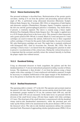 96 G. Silecchia et al.
10.2.2	 Sleeve Gastrectomy (SG)
Our personal technique is described here. Skeletonization of the greater gastric
curvature, starting at 6 cm from the pylorus and proceeding upward until the
angle of His, is performed using ultrasound dissection (Harmonic Scalpel,
Ethicon Endo-Surgery Inc, Cincinnati, OH, USA) or integration of both bipolar
and ultrasonic energies (Thunderbeat, Olympus, Japan). Complete exposure of
the left crus and the gastroesophageal junction is mandatory. Any hiatal defect,
if present, is routinely repaired. The sleeve is created using a linear stapler
(Echelon Flex Endopath, Ethicon Endo-Surgery Inc). The stapler is applied next
to a 42-Fr bougie placed next to the lesser curve. The stomach is then transected,
and a gastric pouch of 80–100 mL is created. Black (4.3 mm) and green (4.1 mm)
cartridges are used to transect the antrum, followed by two or three sequential
yellow cartridges (3.8 mm) for the gastric body and fundus. In case of revisional
SG, only black/green cartridges are used. The staple line is routinely reinforced
with Seamguard (W.L. Gore & Associates Inc, Newark, DE, USA). The last
cartridge is fired at least 1 cm lateral from the esophagogastric junction in order
to preserve vascularization of this critical area. During the vertical dissection, it
is important that the assistant carefully retract the stomach laterally to facilitate
the proper stapler line without torsion.
10.2.3	 Duodenal Sinking
Using an ultrasound dissector or hook coagulator, the pylorus and the first
duodenal portion (3–5 cm) are meticulously prepared avoiding vascular or biliary
lesions. The duodenum is then divided ~2 cm from the pylorus using a linear
stapler with a blue cartridge (3.5 mm) reinforced with buttress material. It might
be necessary to complete mobilization of the upper margin of the duodenum as
far as the pylorus to facilitate the end-to-side duodenoileal anastomosis.
10.2.4	 Ileoileal Anastomosis
The operating table is rotated ~15° to the left. The operator and assistant stand on
the patient’s left side. Once displayed, the caecum and the distal ileal limb, using
an atraumatic grasper marked at 10 cm, the common limb (100 cm), and the
alimentary limb (150 cm) are measured. At the latter level, we proceed with the
division of the small bowel using a 60-mm linear stapler with white cartridges
(2.5 mm). The distal part of the small intestine is anastomosed with the duodenal
stump (end-to-side duodenoileal anastomosis), while the proximal part will
make up the biliary limb to be anastomosed at the preset distance (100 cm from
the ileocecal valve). The side-to-side ileoileal anastomosis defines the common
intestinal limb. Placement of approaching stitches [polydioxanone (PDS) 2-0] on
 