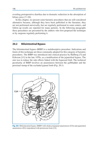 196 M. Lucchese et al.
avoiding postoperative diarrhea due to dramatic reduction in the absorption of
biliary juice [7–10].
In this chapter, we present some bariatric procedures that are still considered
alternative because, although they have been published in the literature, they
are not performed universally, but are regularly performed in some centers, and
follow-up results are reported for many patients. In the following paragraphs
these procedures are presented by the authors who first proposed the technique
or by surgeons regularly performing it.
20.2	 Biliointestinal Bypass
The biliointestinal bypass (BIBP) is a malabsorptive procedure. Indications and
limits of this technique are those commonly adopted for this category of bariatric
procedures. The BIBP was introduced into clinical practice by Hallberg [7] and
Eriksson [11] in the late 1970s, as a modification of the jejunoileal bypass. The
aim was to reduce the side effects linked with the bypassed limb. The technical
peculiarity of BIBP involves an anastomosis between the gallbladder and the
proximal stump of the excluded jejunal limb (Fig. 20.1)
Fig. 20.1 Biliointestinal bypass (BIBP) with cholecystojejunal anastomosis (CJA) and jejunoileal
anastomosis (JIA) (reproduced with permission from [12])
 