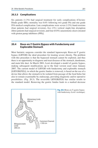 20120	 Other Bariatric Procedures
20.3.3	Complications
Six patients (1.3%) had surgical treatment for early complications (Clavien-
Dindo grade IIIb); mortality was 0.6% following two grade IVa and one grade
IVb medical complication. Late complications were seven (1.5%) band erosions
(four patients had surgical revision), five (1%) vertical staple-line disruption
(three patients had surgical revision), and four (0.8%) anastomotic ulcers [treated
with proton pump inhibitors (PPI)].
20.4	 Roux-en-Y Gastric Bypass with Fundectomy and
Explorable Stomach
Most bariatric surgeons consider the standard laparoscopic Roux-en-Y gastric
bypass (LRYGB) the ideal procedure for treating severe obesity. The problem
with this procedure is that the bypassed stomach cannot be explored, and thus
there is no opportunity to diagnose and treat diseases of the stomach, duodenum,
and main bile duct. In March 2001, Lesti developed a model of gastric bypass,
making subsequent modifications up to the final version used since January
2007. The current model of LRYGB with fundectomy and explorable stomach
[LRYGB(FES)], in which the gastric fundus is removed, is based on the use of a
device that allows the stomach to be isolated from passage of the food bolus but
also to remain examinable by endoscopy, providing diagnostic and/or operative
possibilities. (Fig. 20.3). The reversible LRYGB(FES) has similar results to
the standard model. Removing the gastric fundus leads to a marked decrease
Fig. 20.3 Roux-en-Y gastric bypass
with fundectomy (Lesti’s technique)
Alimentary Limb
200 cm
Biliopancreatic
Limb
200 cm
Common Channel
> 350 cm
 