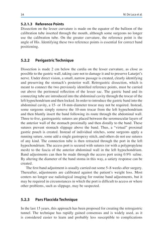 34 M. De Luca et al.
5.2.1.3	 Reference Points
Dissection on the lesser curvature is made on the equator of the balloon of the
calibration tube inserted through the mouth, although some surgeons no longer
use the calibration tube. On the greater curvature, the reference point is the
angle of His. Identifying these two reference points is essential for correct band
positioning.
5.2.2	 Perigastric Technique
Dissection is made 2 cm below the cardia on the lesser curvature, as close as
possible to the gastric wall, taking care not to damage it and to preserve Latarjet’s
nerve. Under direct vision, a small, narrow passage is created, clearly identifying
and preserving the stomach’s posterior wall. Retrogastric dissection, which is
meant to connect the two previously identified reference points, must be carried
out above the peritoneal reflection of the lesser sac. The gastric band and its
connecting tube are introduced into the abdominal cavity through the trocar of the
left hypochondrium and then locked. In order to introduce the gastric band into the
abdominal cavity, a 15- or 18-mm-diameter trocar may not be required. Instead,
some surgeons simply remove the 10-mm trocar from the left hypochondrium
and then bluntly insert the band following its route through the abdominal wall.
Three to five, gastrogastric sutures are placed between the seromuscular layers of
the anterior wall of the stomach proximally and then distally to the band. These
sutures prevent stomach slippage above the band. Thus, a “virtual” proximal
gastric pouch is created. Instead of individual stitches, some surgeons apply a
running suture, some add a single gastropexy stitch, and others do not use sutures
of any kind. The connection tube is then retracted through the port in the left
hypochondrium. The access port is secured with sutures (or with a polypropylene
mesh) to the fascia of the anterior abdominal wall in the left hypochondrium.
Band adjustments can then be made through the access port using 0.9% saline.
By altering the diameter of the band stoma in this way, a satiety response can be
created.
The first band adjustment is usually carried out some 5–8 weeks after surgery.
Thereafter, adjustments are calibrated against the patient’s weight loss. Most
centers no longer use radiological imaging for routine band adjustments, but it
may be required in circumstances in which the port is difficult to access or where
other problems, such as slippage, may be suspected.
5.2.3	 Pars Flaccida Technique
In the last 15 years, this approach has been proposed for creating the retrogastric
tunnel. The technique has rapidly gained consensus and is widely used, as it
is considered easier to learn and probably less susceptible to complications
 