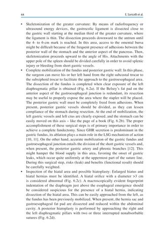 44 E. Soricelli et al.
•	 Skeletonization of the greater curvature: By means of radiofrequency or
ultrasound energy devices, the gastrocolic ligament is dissected close to
the gastric wall starting at the median third of the greater curvature, where
the ligament is thin. The dissection proceeds downward to the antrum until
the 4- to 6-cm mark is reached. In this area, access to the omental bursa
might be difficult because of the frequent presence of adhesions between the
posterior wall of the stomach and the anterior aspect of the pancreas. Then,
skeletonization proceeds upward to the angle of His. Attachments with the
upper pole of the spleen should be divided carefully in order to avoid splenic
injury or bleeding from short gastric vessels.
•	 Complete mobilization of the fundus and posterior gastric wall: In this phase,
the surgeon can move his or her left hand from the right subcostal trocar to
the subxiphoid trocar to facilitate the approach to the gastroesophageal area.
The dissection of the fundus is completed when clear exposure of the left
diaphragmatic pillar is obtained (Fig. 6.2a). If the Belsey’s fat pad on the
anterior aspect of the gastroesophageal junction is redundant, its resection
may be useful to properly expose the area where the stapler will be placed.
The posterior gastric wall must be completely freed from adhesions. When
present, posterior gastric vessels should be divided, as they can lessen
compliance of the stomach during resection. At the end of mobilization, the
left gastric vessels and left crus are clearly exposed, and the stomach can be
easily moved on this axis – like the page of a book (Fig. 6.2b). The proper
accomplishment of these surgical steps is of primary importance in order to
achieve a complete fundectomy. Since GHR secretion is predominant in the
gastric fundus, its ablation plays a main role in the LSG mechanism of action
[10, 11]. On the other hand, accurate mobilization of the gastric fundus and
gastroesophageal junction entails the division of the short gastric vessels and,
when present, the posterior gastric artery and phrenic branches [12]. This
might hamper the blood supply in this area, favoring the onset of gastric
leaks, which occur quite uniformly at the uppermost part of the suture line.
During this surgical step, risks (leak) and benefits (functional result) should
be carefully weighted.
•	 Inspection of the hiatal area and possible hiatoplasty: Enlarged hiatus and
hiatal hernias must be identified. A hiatal orifice with a diameter >3 cm
is considered abnormal (Fig. 6.2c). A macroscopically evident fingerprint
indentation of the diaphragm just above the esophageal emergence should
be considered suspicious for the presence of a hiatal hernia, indicating
dissection of the hiatal area. This can be easily approached from the left, as
the fundus has been previously mobilized. When present, the hernia sac and
gastroesophageal fat pad are dissected and reduced within the abdominal
cavity. A posterior hiatoplasty is performed by approaching the right and
the left diaphragmatic pillars with two or three interrupted nonabsorbable
sutures (Fig. 6.2d).
 