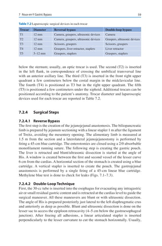 597	 Roux-en-Y Gastric Bypass
below the sternum; usually, an optic trocar is used. The second (T2) is inserted
in the left flank, in correspondence of crossing the umbilical transversal line
with an anterior axillary line. The third (T3) is inserted in the front right upper
quadrant a few centimeters below the costal margin in the midclavicular line.
The fourth (T4) is positioned as T3 but in the right upper quadrant. The fifth
(T5) is positioned a few centimeters under the xiphoid. Additional trocars can be
positioned according to the patient’s anatomy. Trocar diameter and laparoscopic
devices used for each trocar are reported in Table 7.2.
7.2.4	 Surgical Steps
7.2.4.1	 Reverse Bypass
The first step is the creation of the jejunojejunal anastomosis. The biliopancreatic
limb is prepared by jejunum sectioning with a linear stapler 1 m after the ligament
of Treitz, avoiding the mesentery opening. The alimentary limb is measured at
1.5 m from the section and a laterolateral jejunojejunostomy is performed by
firing a 45-cm blue cartridge. The enterotomies are closed using a 2/0 absorbable
monofilament running suture. The following step is creating the gastric pouch.
The liver is retracted and blunt/ultrasonic dissection is started at the angle of
His. A window is created between the first and second vessel of the lesser curve
6 cm from the cardias. A horizontal section of the stomach is created using a blue
cartridge. A vertical stapler is inserted to create the pouch. The gastrojejunal
anastomosis is performed by a single firing of a 45-cm linear blue cartridge.
Methylene blue test is done to check for leaks (Figs. 7.1–7.3).
7.2.4.2	 Double-Loop Technique
First, the 30-cc tube is inserted into the esophagus for evacuating any intragastric
air or small residual gastric content and is retracted at the cardias level to guide the
surgical maneuver. All these maneuvers are blunt or with ultrasonic dissection.
The angle of His is prepared posteriorly just lateral to the left diaphragmatic crus
and anteriorly as deep as possible. Blunt and ultrasonic dissection is done on the
lesser sac to access the epiploon retrocavity (4–5 cm below the gastroesophageal
junction). After freeing all adhesions, a linear articulated stapler is inserted
perpendicularly to the lesser curvature to cut the stomach horizontally. Usually,
Table 7.2 Laparoscopic surgical devices in each trocar
Trocar	 Diameter	 Reversal bypass	 Double-loop bypass
T1	 12 mm	 Camera, graspers, ultrasonic devices	 Camera
T2	 12 mm	 Camera, graspers, ultrasonic devices	 Graspers, ultrasonic devices
T3	 12 mm	 Scissors, graspers	 Scissors, graspers
T4	 12 mm	 Graspers, liver retractor, staplers	 Liver retractor
T5	 5–12 mm	 Graspers, staplers	 Graspers, staplers
 