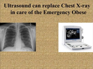 Ultrasound can replace Chest X-ray
in care of the Emergency Obese

 