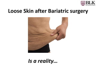 Loose Skin after Bariatric surgery
Is a reality…
 