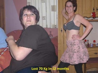 Lost 70 Kg in 12 months
 