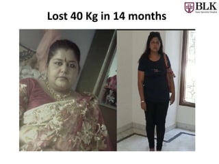 Lost 40 Kg in 14 months
 
