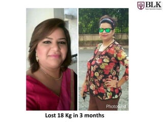 Lost 18 Kg in 3 months
 