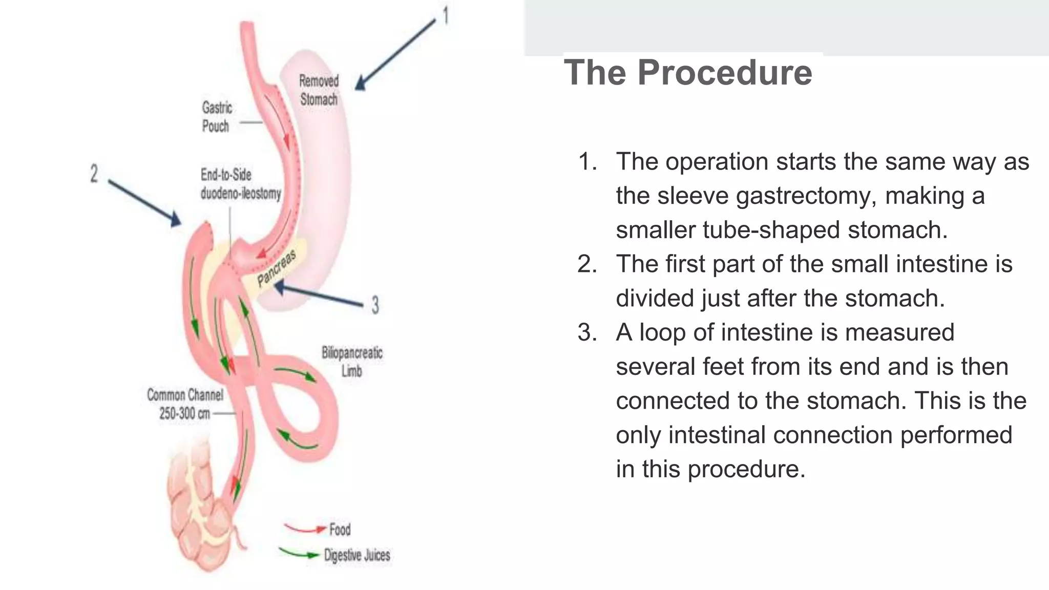 Bariatric Surgery (1).pptx