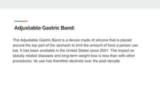 Adjustable Gastric Band:
The Adjustable Gastric Band is a device made of silicone that is placed
around the top part of the stomach to limit the amount of food a person can
eat. It has been available in the United States since 2001. The impact on
obesity related diseases and long-term weight loss is less than with other
procedures. Its use has therefore declined over the past decade.
 