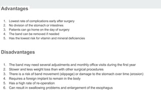 Advantages
1. Lowest rate of complications early after surgery
2. No division of the stomach or intestines
3. Patients can go home on the day of surgery
4. The band can be removed if needed
5. Has the lowest risk for vitamin and mineral deficiencies
Disadvantages
1. The band may need several adjustments and monthly office visits during the first year
2. Slower and less weight loss than with other surgical procedures
3. There is a risk of band movement (slippage) or damage to the stomach over time (erosion)
4. Requires a foreign implant to remain in the body
5. Has a high rate of re-operation
6. Can result in swallowing problems and enlargement of the esophagus
 