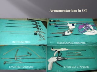 Armamentarium in OT
INSTRUMENTS TELESCOPES,TROCARS
LIVER RETRACTORS ENDO-GIA STAPLERS
 