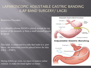 LAPAROSCOPIC ADJUSTABLE GASTRIC BANDING
(LAP BAND SURGERY/ LAGB)
Restrictive Procedure
An inflatable silicone BAND is placed around the top
portion of the stomach, to form a small stomach pouch
& sewed .
This band is connected to a tube that leads to a port
above the abdominal muscles placed below the skin
(FILL – PORT).
During follow up visits, we inject or remove saline
solution to make the band tighter or looser.
 