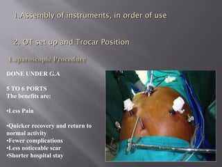 DONE UNDER G.A
5 TO 6 PORTS
The benefits are:
•Less Pain
•Quicker recovery and return to
normal activity
•Fewer complications
•Less noticeable scar
•Shorter hospital stay
1.1.Assembly of instruments, in order of useAssembly of instruments, in order of use
2.2. OT set up and Trocar PositionOT set up and Trocar Position
 