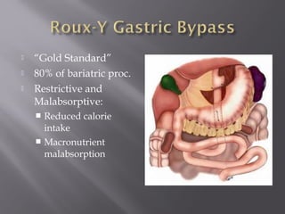  “Gold Standard”
 80% of bariatric proc.
 Restrictive and
Malabsorptive:
 Reduced calorie
intake
 Macronutrient
malabsorption
 