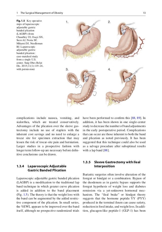 Bariatric surgery complications