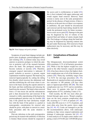 Bariatric surgery complications | PDF