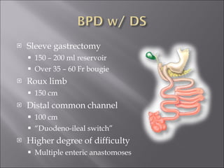 Sleeve gastrectomy 150 – 200 ml reservoir Over 35 – 60 Fr bougie Roux limb 150 cm Distal common channel 100 cm “ Duodeno-ileal switch” Higher degree of difficulty Multiple enteric anastomoses 