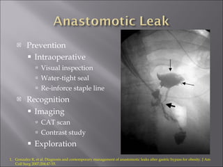 Prevention Intraoperative   Visual inspection Water-tight seal Re-inforce staple line Recognition Imaging  CAT scan Contrast study Exploration Gonzalez R, et al. Diagnosis and contemporary management of anastomotic leaks after gastric bypass for obesity. J Am Coll Surg 2007;204:47-55. 