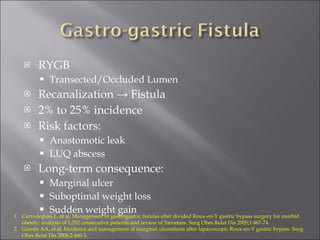 RYGB Transected/Occluded Lumen Recanalization -> Fistula 2% to 25% incidence Risk factors: Anastomotic leak LUQ abscess Long-term consequence: Marginal ulcer Suboptimal weight loss Sudden weight gain Carrodeguas L, et al. Management of gastrogastric fistulas after divided Roux-en-Y gastric bypass surgery for morbid obesity: analysis of 1,292 consecutive patients and review of literature. Surg Obes Relat Dis 2005;1:467-74. Gumbs AA, et al. Incidence and management of marginal ulcerations after laparoscopic Roux-en-Y gastric bypass. Surg Obes Relat Dis 2006;2:460-3. 
