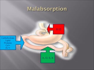 Carbohydrate Lipid Proteins Ca²+ Fe ²+ B 12 A, D, E, K 
