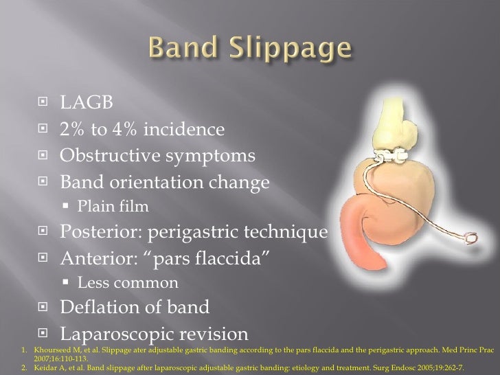 Bariatric Surgery Options, Trends, and Latest Innovations