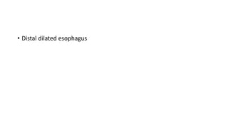 • Distal dilated esophagus
 