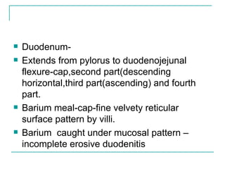 Duodenum- Extends from pylorus to duodenojejunal flexure-cap,second part(descending horizontal,third part(ascending) and fourth part. Barium meal-cap-fine velvety reticular surface pattern by villi. Barium  caught under mucosal pattern – incomplete erosive duodenitis 
