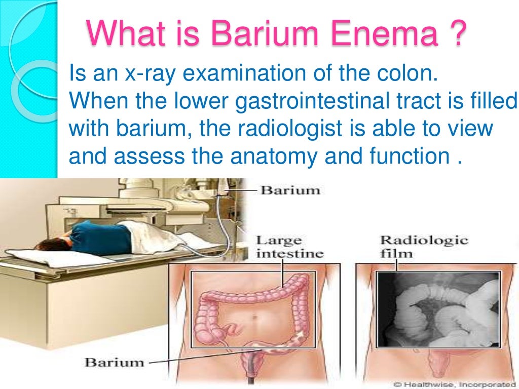 Barium enema
