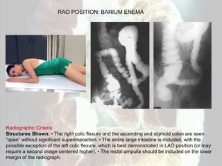 Barium enema | PPT