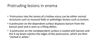 Protruding lesions in enema
• Protrusions into the lumen of a hollow viscus can be either normal
structures such as mucosal folds or pathologic lesions such as tumors.
• A protrusion on the dependent surface displaces barium from the
barium pool and is seen as a filling defect.
• A protrusion on the nondependent surface is coated with barium and
the X ray beam catches the edges of the protrusions, which are then
"etched in white."
 