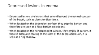 Depressed lesions in enema
• Depressed lesions are lesions that extend beyond the normal contour
of the bowel, such as ulcers or diverticula.
• When located on the dependent surface, they trap the barium and
therefore are seen as a focal barium collections.
• When located on the nondependent surface, they empty of barium. If
there is adequate coating of the sides of the depressed lesion, it is
seen as a ring shadow.
 