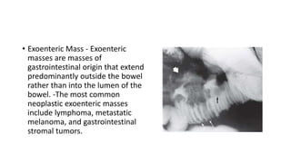 • Exoenteric Mass - Exoenteric
masses are masses of
gastrointestinal origin that extend
predominantly outside the bowel
rather than into the lumen of the
bowel. -The most common
neoplastic exoenteric masses
include lymphoma, metastatic
melanoma, and gastrointestinal
stromal tumors.
 
