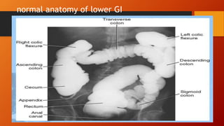 normal anatomy of lower GI
 