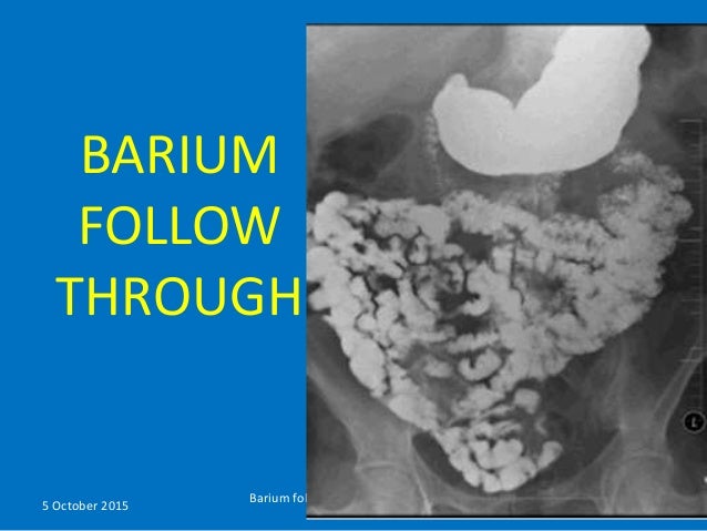 Barium follow through small bowel enema ranju