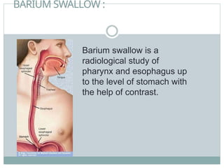BARIUM SWALLOW :
Barium swallow is a
radiological study of
pharynx and esophagus up
to the level of stomach with
the help of contrast.
 