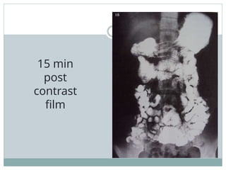 15 min
post
contrast
film
 