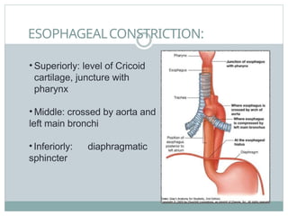 ESOPHAGEALCONSTRICTION:
• Superiorly: level of Cricoid
cartilage, juncture with
pharynx
• Middle: crossed by aorta and
left main bronchi
• Inferiorly: diaphragmatic
sphincter
 