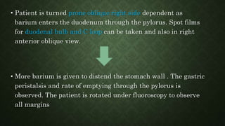 • Patient is turned prone oblique right side dependent as
barium enters the duodenum through the pylorus. Spot films
for duodenal bulb and C loop can be taken and also in right
anterior oblique view.
• More barium is given to distend the stomach wall . The gastric
peristalsis and rate of emptying through the pylorus is
observed. The patient is rotated under fluoroscopy to observe
all margins
 