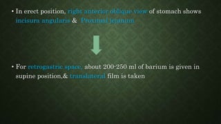 • In erect position, right anterior oblique view of stomach shows
incisura angularis & Proximal jejunum
• For retrogastric space, about 200-250 ml of barium is given in
supine position,& translateral film is taken
 