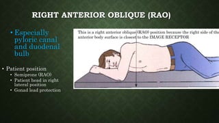 RIGHT ANTERIOR OBLIQUE (RAO)
• Especially
pyloric canal
and duodenal
bulb
• Patient position
• Semiprone (RAO)
• Patient head in right
lateral position
• Gonad lead protection
This is a right anterior oblique (RAO) position because the right side of the
anterior body surface is closest to the IMAGE RECEPTOR
 