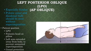 LEFT POSTERIOR OBLIQUE
(LPO)
(AP OBLIQUE)• Especially fundus
• Pyloric canal and
duodenal bulb
should be seen
without
superimposition
• Patient position
• LPO
• Patients head on
pillow
• Left arm extended
away from body, to
prevent unwanted
superimposition
• Gonad protection
 