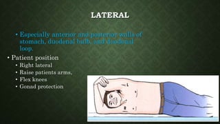 LATERAL
• Especially anterior and posterior walls of
stomach, duodenal bulb, and duodenal
loop.
• Patient position
• Right lateral
• Raise patients arms,
• Flex knees
• Gonad protection
 
