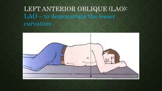 LEFT ANTERIOR OBLIQUE (LAO):
LAO – to demonstrate the lesser
curvature
 