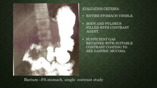 Barium –PA stomach, single contrast study
EVALUATION CRITERIA:
• ENTIRE STOMACH VISIBLE.
• BODY AND PYLORUS
FILLED WITH CONTRAST
AGENT.
• SUFFICIENT GAS
RETAINED WITH SUITABLE
CONTRAST COATING TO
SEE GASTRIC MUCOSA.
 